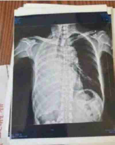 国医楷模陈海林 | 癌细胞逆转正常生理细胞 引起全球广泛关注 —— 五一特别报道